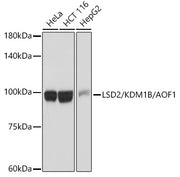 LSD2/KDM1B/AOF1 Rabbit mAb