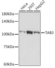 TAB3 Rabbit mAb