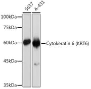 Cytokeratin 6 (KRT6) Rabbit mAb
