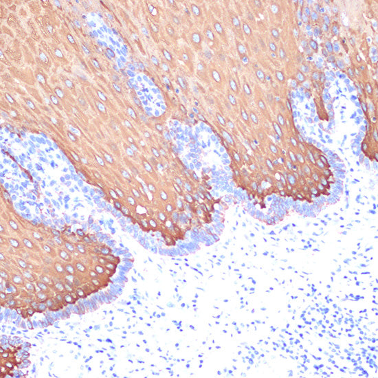 Cytokeratin 6 (KRT6) Rabbit mAb