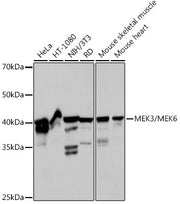 MEK3/MEK6 Rabbit mAb