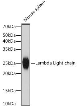 Lambda Light chain Rabbit mAb