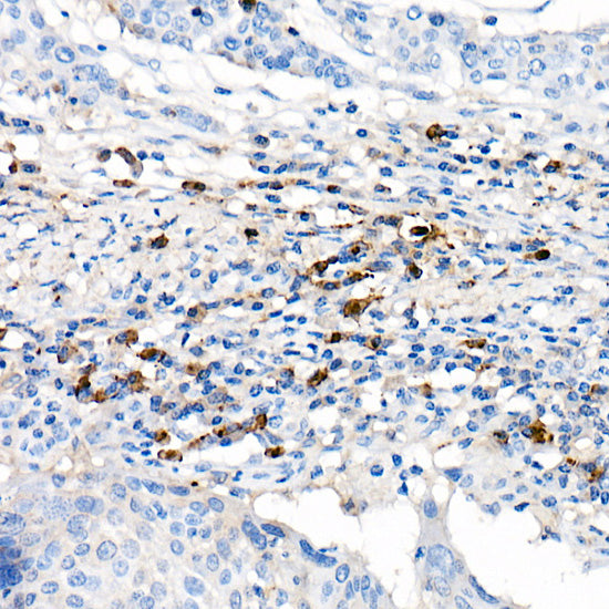 Lambda Light chain Rabbit mAb