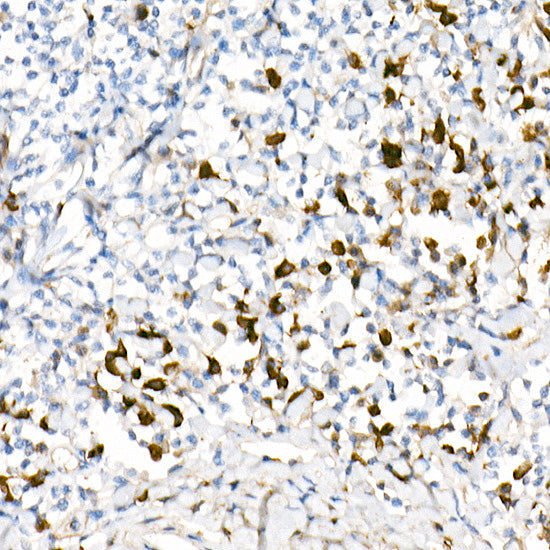 Lambda Light chain Rabbit mAb