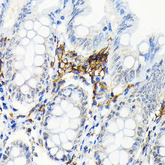 HLA-DRB1 Rabbit mAb