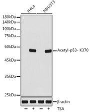 Acetyl-p53- K370 Rabbit mAb