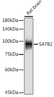SATB2 Rabbit mAb