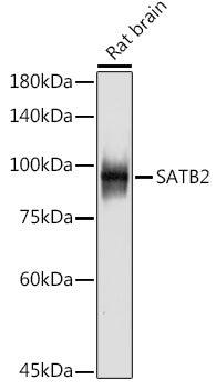 SATB2 Rabbit mAb