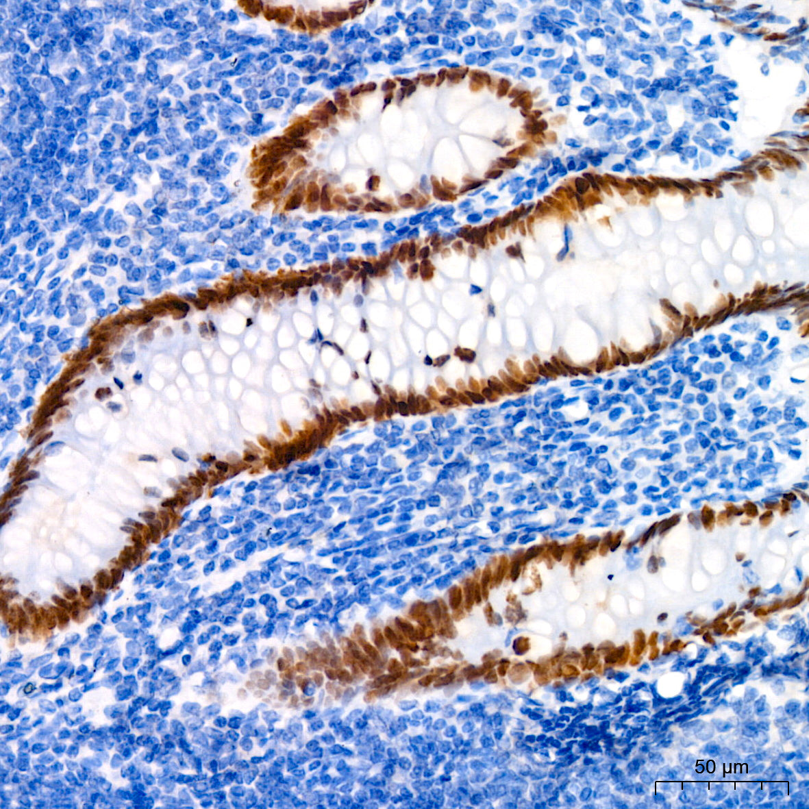 SATB2 Rabbit mAb