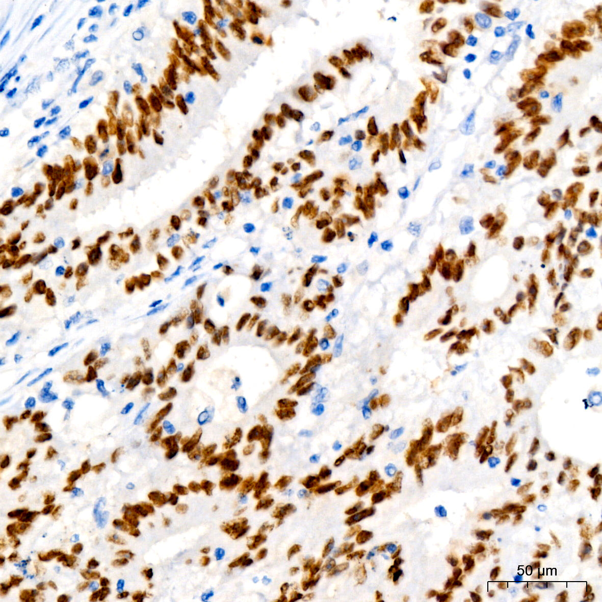 SATB2 Rabbit mAb