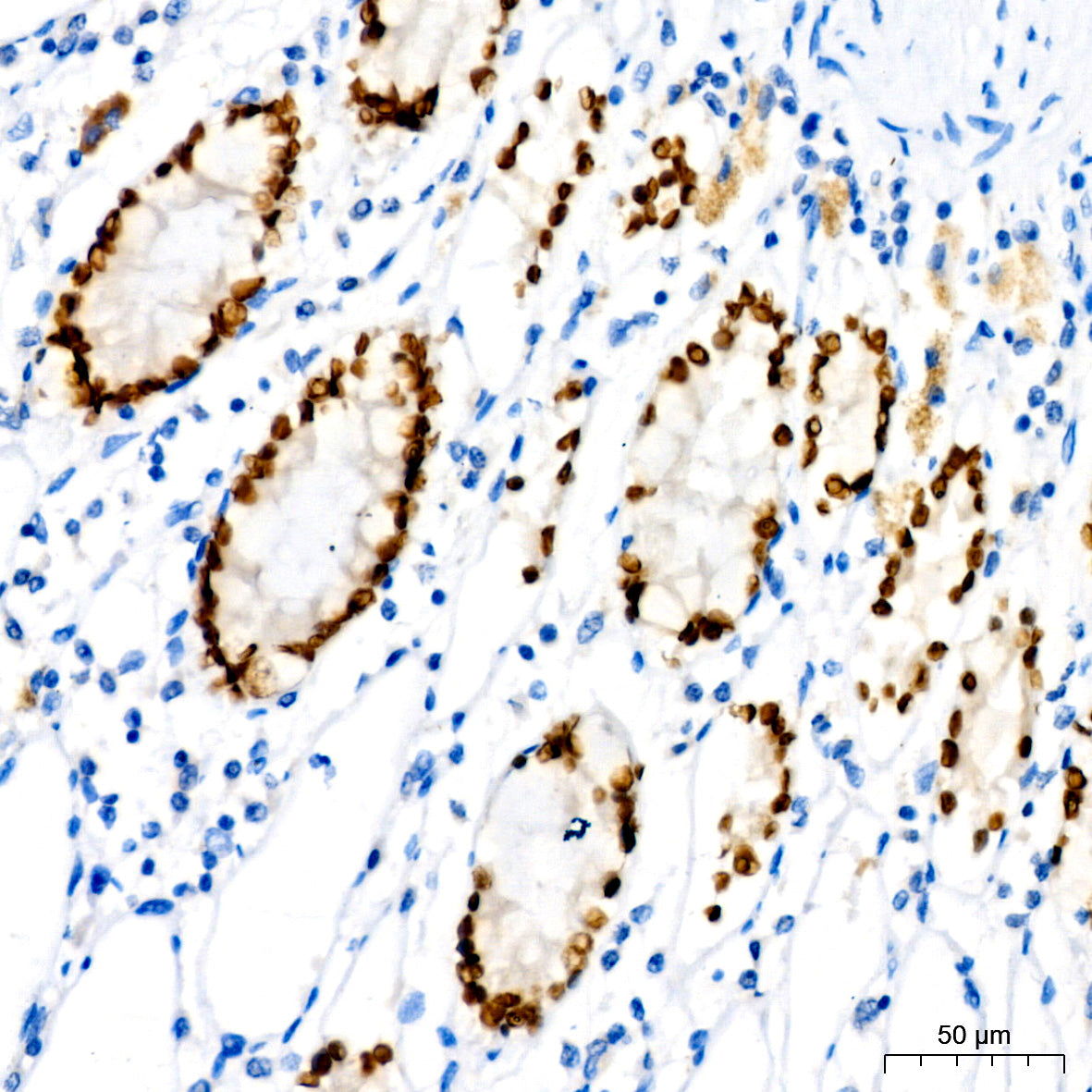 SATB2 Rabbit mAb