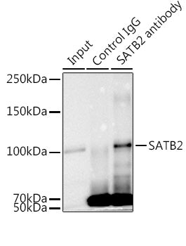SATB2 Rabbit mAb