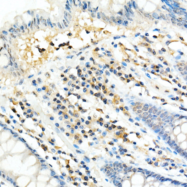 FADD Rabbit mAb