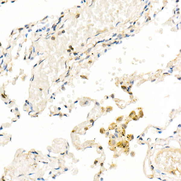 FADD Rabbit mAb
