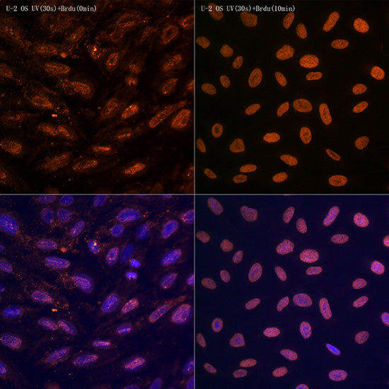 N6-methyladenosine / m6A Rabbit mAb