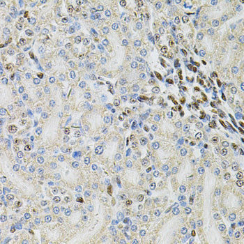 PSMC3 Rabbit pAb