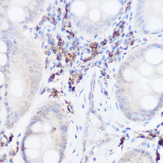 Thromboxane synthase Rabbit pAb