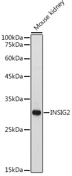 INSIG2 Rabbit pAb