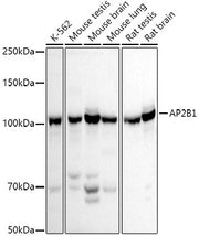 AP2B1 Rabbit pAb