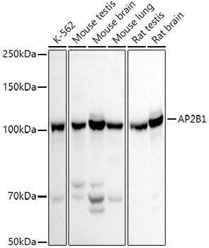 AP2B1 Rabbit pAb