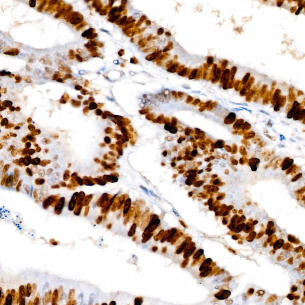 [KO Validated] Ki67 Rabbit mAb