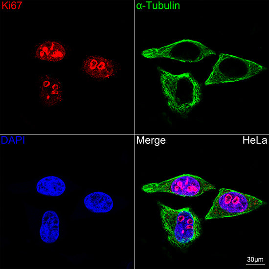 [KO Validated] Ki67 Rabbit mAb