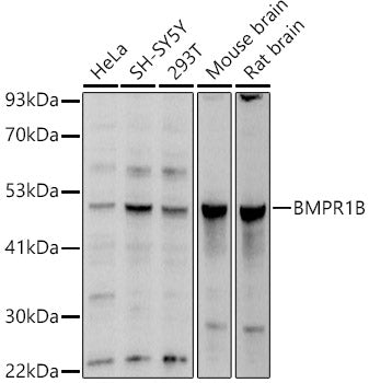 BMPR1B Rabbit pAb