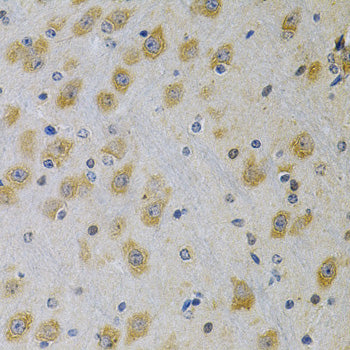 IGFBP4 Rabbit pAb