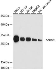 SNRPB Rabbit pAb