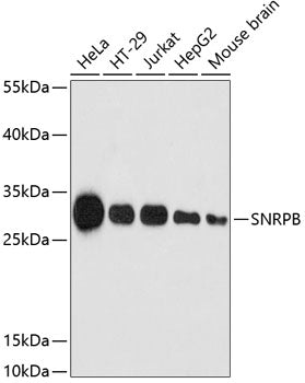 SNRPB Rabbit pAb