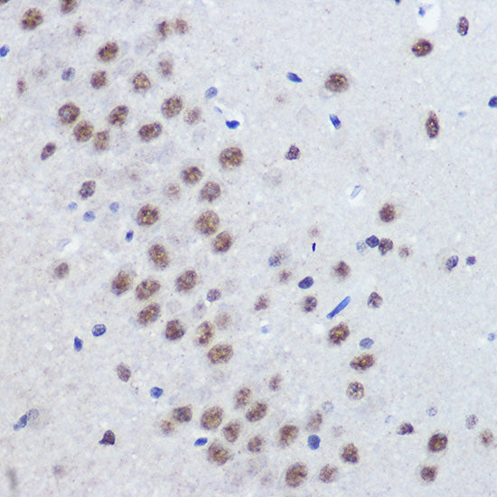 JMJD1C Rabbit pAb
