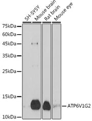 ATP6V1G2 Rabbit pAb