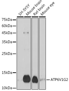 ATP6V1G2 Rabbit pAb