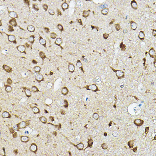ATP6V1G2 Rabbit pAb