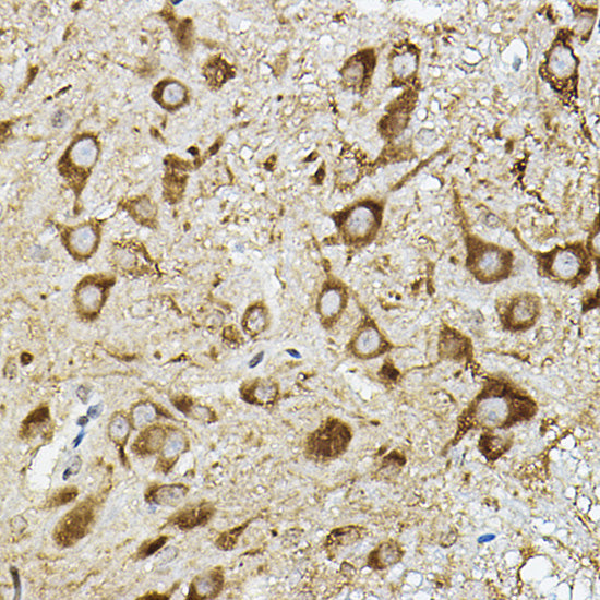 ATP6V1G2 Rabbit pAb