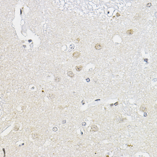 RING1A Rabbit pAb