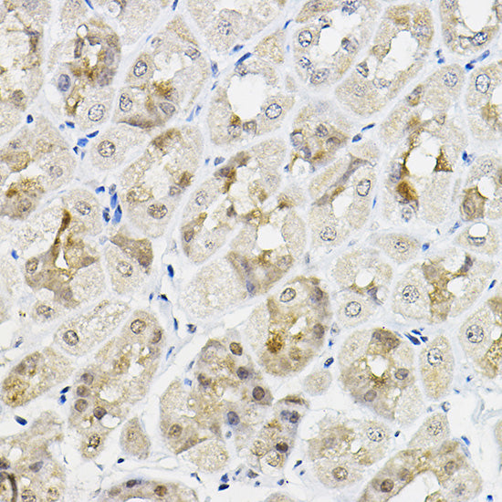 RING1A Rabbit pAb