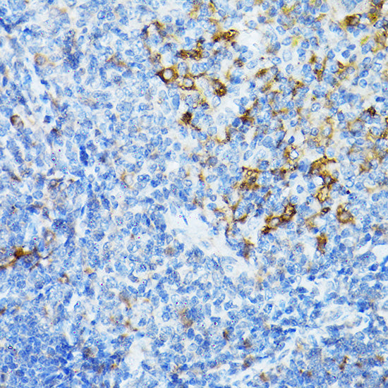 STING/TMEM173 Rabbit pAb