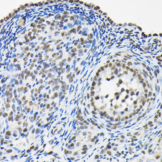 HNRNPA3 Rabbit pAb
