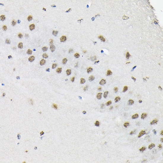 HNRNPA3 Rabbit pAb