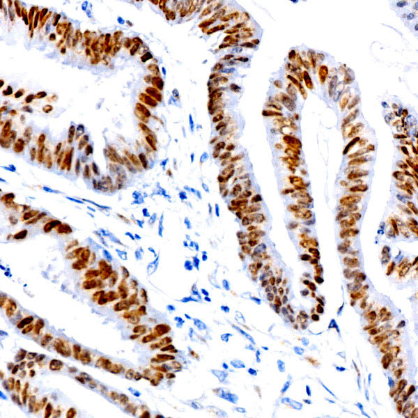 SATB2 Rabbit mAb