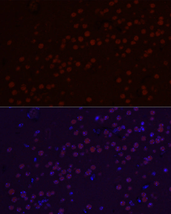 SATB2 Rabbit mAb