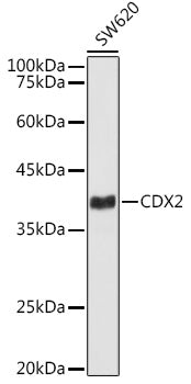 [KD Validated] CDX2 Rabbit mAb