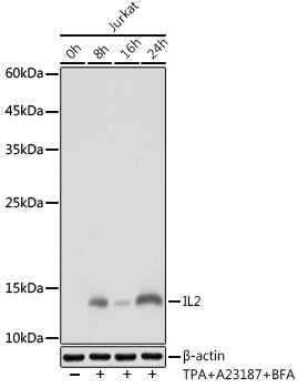 IL2 Rabbit mAb