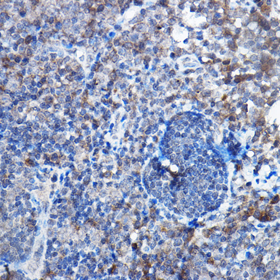 [KO Validated] Bax Rabbit mAb