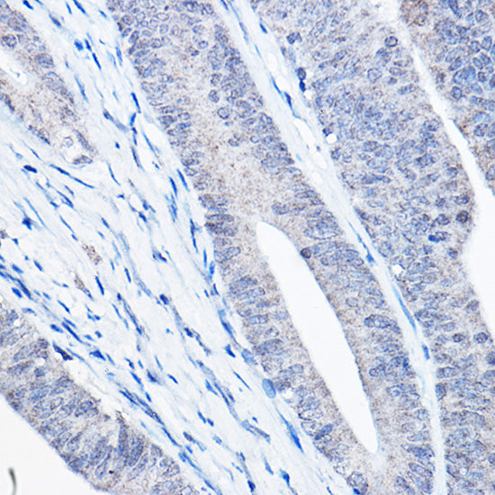 [KO Validated] Bax Rabbit mAb