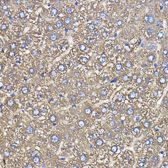 Ceruloplasmin Rabbit mAb