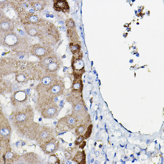 Ceruloplasmin Rabbit mAb