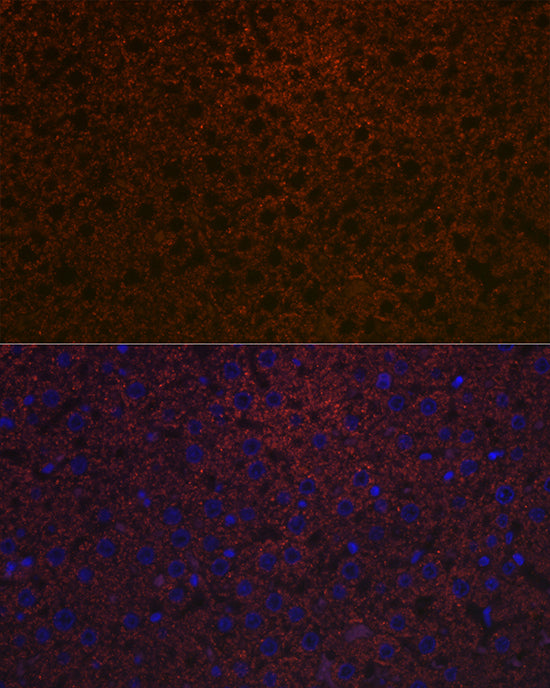 Ceruloplasmin Rabbit mAb