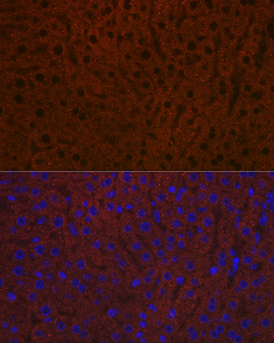 Ceruloplasmin Rabbit mAb